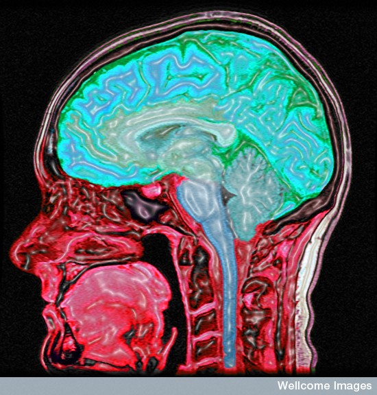 B0005623 Enhanced MRI scan of the head Credit: Mark Lythgoe & Chloe Hutton. Wellcome Images images@wellcome.ac.uk http://images.wellcome.ac.uk Digitally enhanced MRI of the human head showing the brain and spinal cord in blue/green and the other tissues in red and pink. Magnetic resonance imaging 2004 Published: - Copyrighted work available under Creative Commons by-nc-nd 2.0 UK, see http://images.wellcome.ac.uk/indexplus/page/Prices.html